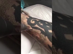 pico second laser machine for tattoo removal